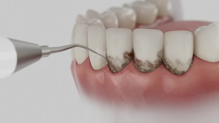 Reliable Invisalign Clear Aligners contractor in Boundary County County, ID by Dentist Open Now